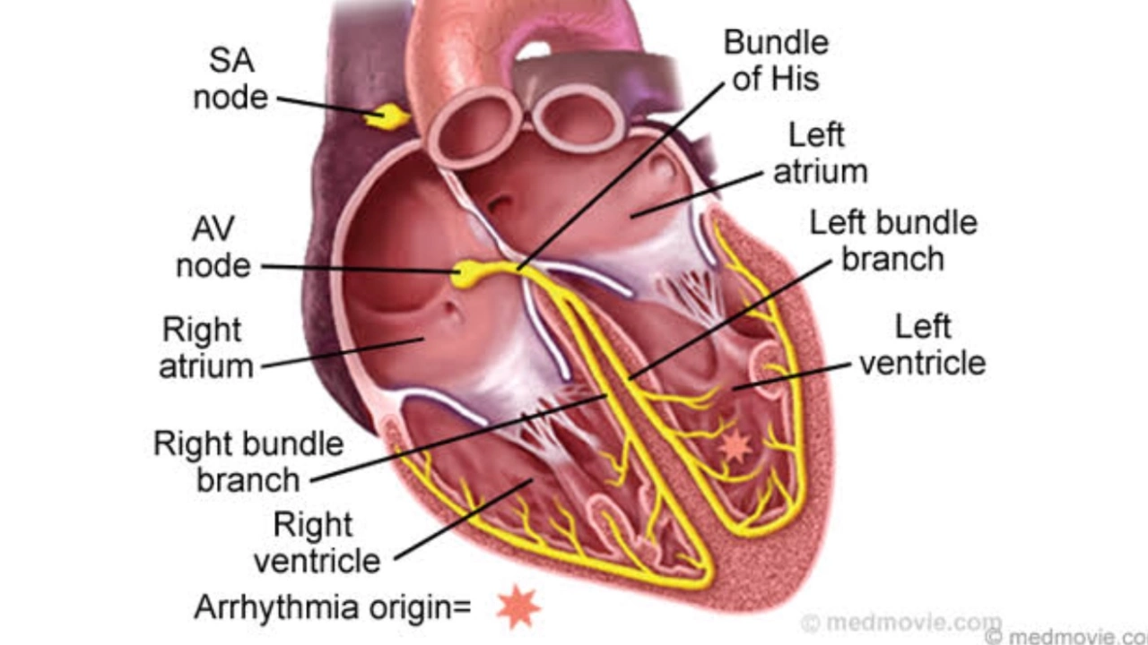 The Connection Between Supraventricular Tachycardia and Congenital Heart Disease