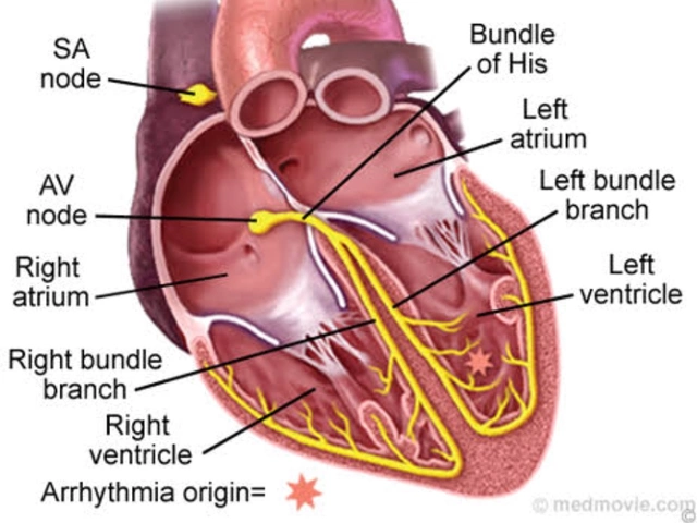 The Connection Between Supraventricular Tachycardia and Congenital Heart Disease